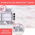 thumbnail image 5 of Electrocardiogram 7 Step Ruler Card for Accurate Interpretation and Quick Analysis in Setting Assessment Tool, 5 of 5