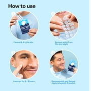 Hanhoo Extra Strength Blemish Patch with Salicylic Acid and Hydrocolloid, Latex-Free, Acne Treatment for All Skin Types, 36 Ct.