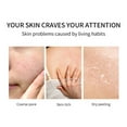 thumbnail image 4 of Fiudx Ofertas De La Semana Jabón De Bálsamo De Sebo Jabón De Sebo Jabón Hecho A Mano Limpieza De Rostro Y Espalda Jabón De Belleza Control De Aceite Hidratante Lavado De Cara Jabón De Baño 113 G/4 Oz, 4 of 6