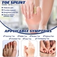 thumbnail image 7 of Toe Straightener,Happon 4 Pcs Toe Splints,Toe Brace for Broken Toe straighteners for Hammer Toe Straightener Fixation Corrector Strap for Bent Toe,Hammer Toe,Crooked Toe,Claw Toe(Beige), 7 of 7