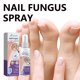 thumbnail image 4 of Spray para hongos en las uñas - Cuidado desodorizante para uñas grises e infecciones por hongos, 100 ml, 4 of 4