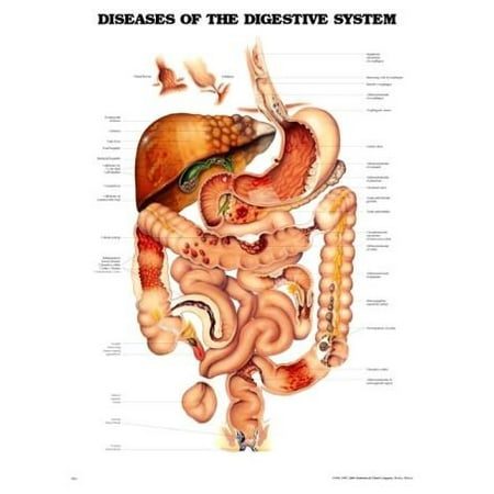 - Diseases of the Digestive System Anatomical Chart