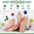 thumbnail image 3 of Athletes Foot Spray, Antifungal Spray Athletes Foot Treatment, Anti Fungal Treatment for Feet Itchy, Sweating, Peeling and Blisters, Natural Ingredients Foot Fungal Spray for Tinea Pedis, 3 of 7
