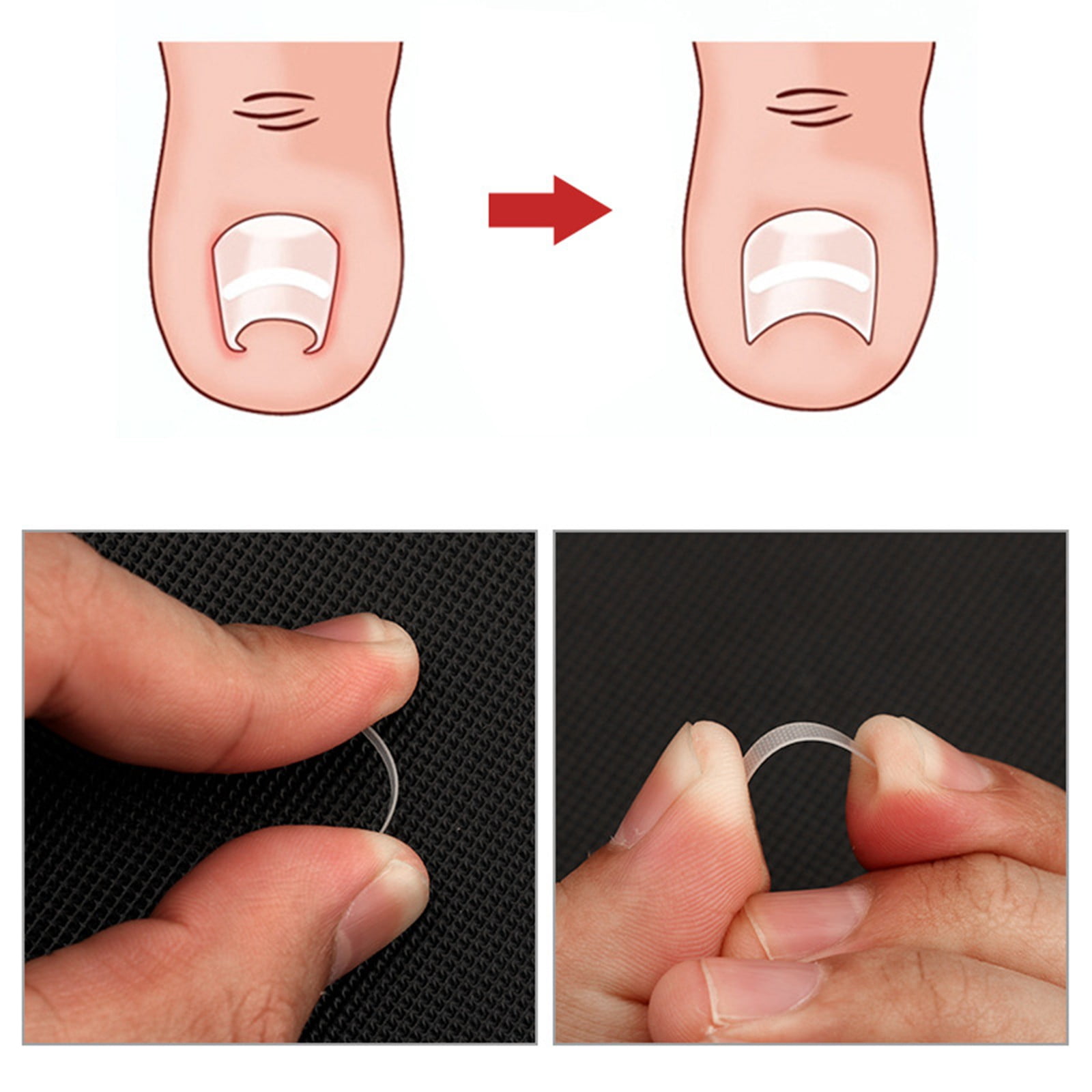 Heel Smoother for Feet Glow Baby Peel Pads Health Feet Crack Heel Socks Pumice Remover Pedicure Vacuum Feet Foot File Foot Brush for Skin Famous Feet Remover Wart Remover Pedicure File for