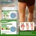 3 PACK Varicose Vein Miracle Cream,vitamin k cream,Varicose Vein Cream