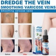 thumbnail image 3 of Aerosol para venas varicosas South Moon de 30 ml, seguro, no tóxico, mejora la varicosidad South Moon 30ml, 3 of 7