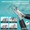 thumbnail image 6 of RONAVO Heavy Duty Toenail Clippers for Ingrown Toenails, Slanted Curved Blade Professional Toe Nail Clippers for Fine Trimming, Nail Clipper with Anti-Slip Long Handle for Men Seniors, 6 of 7