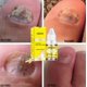 thumbnail image 2 of Aceite Esencial para el Cuidado de Hongos en las Uñas, Solución Antibacteriana para el Cuidado de los Pies y Manicura, 10ml, 2 of 5