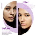 thumbnail image 4 of Suero de Retinol Art Naturals 2,5% con Vitamina C y Ácido Hialurónico para Rostro y Piel Sensible, 4 of 8