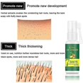 thumbnail image 3 of ExquisiteHair Regrow 7 Day, Ginger Germinal Essential Oil Hair Growth Hair Loss Treatment Hair Care Hair Growth Serum for Men & Women 30m, 3 of 5