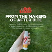 The Itch Eraser Spray - 0.95 Fl Oz - Pack of 4