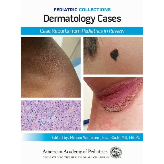 Pediatric Collections Pediatric Collections: Dermatology Cases: Case Reports from Pediatrics in Review, (Paperback)