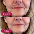 thumbnail image 7 of Glabrous Skin Epilator, Glabrous Skin Hair Remover for Face - Look Glamorous with Glabrous skin Hair Removal, 7 of 7