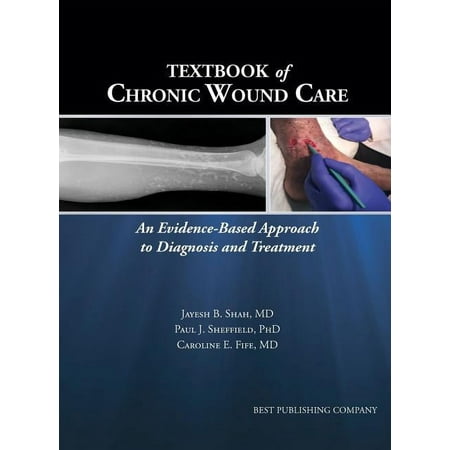 UPC: 9781947239074 | Textbook of Chronic Wound Care: An Evidence-Based Approach to Diagnosis Treatment (Hardcover)
