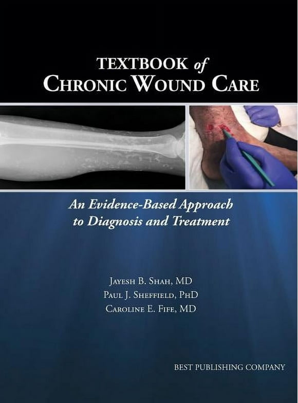 Textbook of Chronic Wound Care: An Evidence-Based Approach to Diagnosis Treatment (Hardcover)