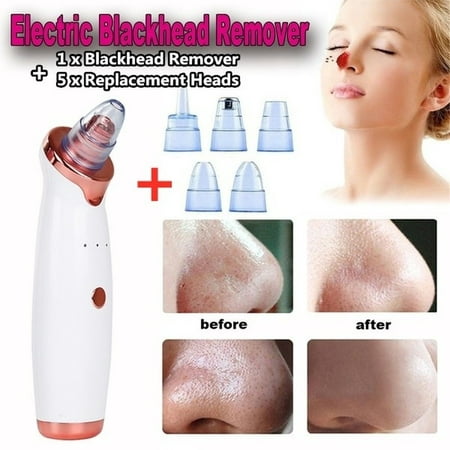 2019 Newest Professional Blackhead Vacuum Acne Cleaner Pore Remover Electric Skin Facial Cleanser (Best Skin Care In The World 2019)