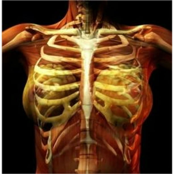 Costochondritis Causes, Symptoms and Treatments eBook