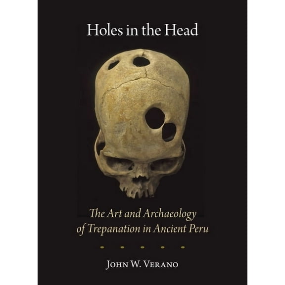 Dumbarton Oaks Pre-Columbian Art and Archaeology Studies: Holes in the Head: The Art and Archaeology of Trepanation in Ancient Peru (Paperback)