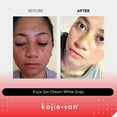 Kojie San Dream White Soap Skin Brightening Kojic Acid Soap with Collagen, Elastin & Coconut