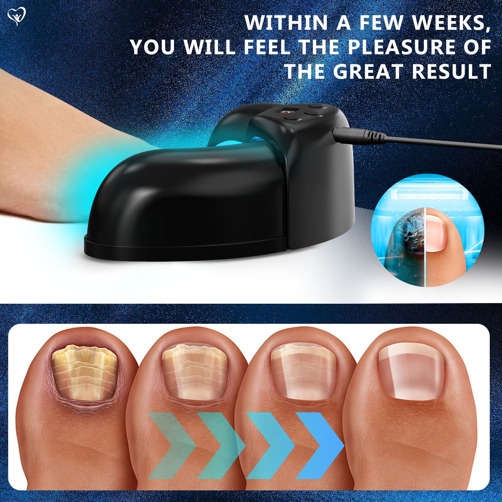 Nail Fungus Cleaning Light Therapy Device – Adjustable 3, 5, 10 Minute Sessions – Treat Multiple Fingers & Toes-12pcs 470nm & 6pcs 910nm for Home Use Treat and Highly Effectively Prevent