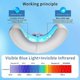 thumbnail image 4 of Nail Fungus Light Treatment 470nm Blue + 905nm Infrared Light for Fingernail & Toenail Repair, Home Use Onychomycosis Laser Therapy, 4 of 5