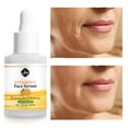 thumbnail image 3 of Vitamina C Hidratante Suave 30Ml Hot6sl, 3 of 7