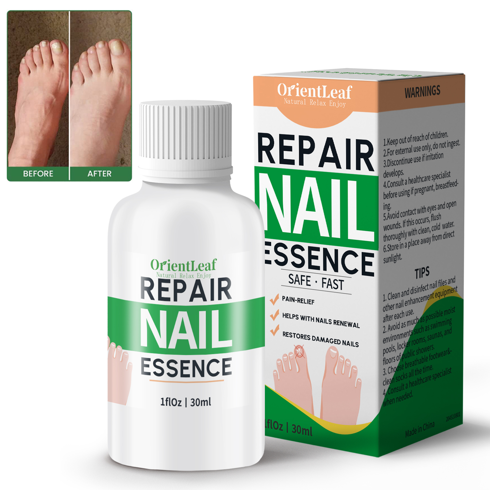 OrientLeaf Nail and Toenail Fungus Treatment, Perfect for Both Toenails