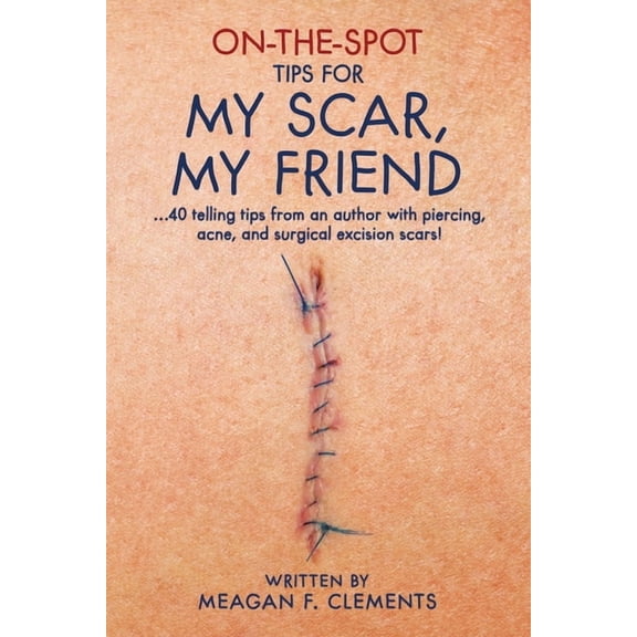 On-The-Spot On-The-Spot Tips For My Scar, My Friend: ...40 telling tips from an author with piercing, acne, and surgical excision sc, Book 7, (Paperback)