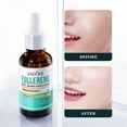 thumbnail image 4 of Sadoer Fullerene Anti-Aging Skin Repair Essence (Foreign Edition) (New) 30ml, 4 of 9