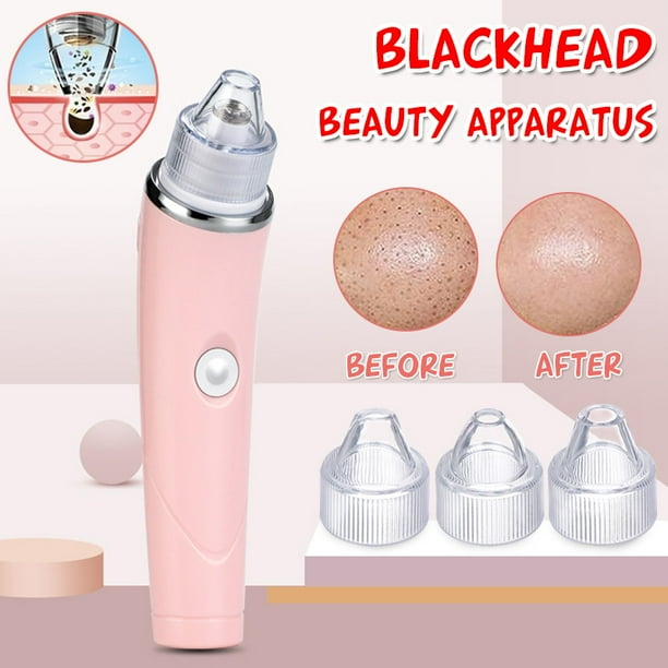 Electric Blackhead Remover Pore Cleaner Vacuum Suction Facial Blackhead