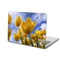 thumbnail image 5 of KSK KAISHEK Hard Shell Case for 2012/2013/2014/2015 Rel. Old MacBook Pro 13" with No Touch No CD-ROM, No USB-C Model: A1425 & A1502 Flower 1720, 5 of 5