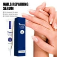thumbnail image 4 of Fiudx Suero para El Crecimiento de Uñas, Líquido para Una Recuperación Rápida, Aceite Fortalecedor para Uñas Finas, Fórmula Hidratante Vegetal, Aplicación Diaria para Uñas Más Fuertes, Ideal para Ama, 4 of 6