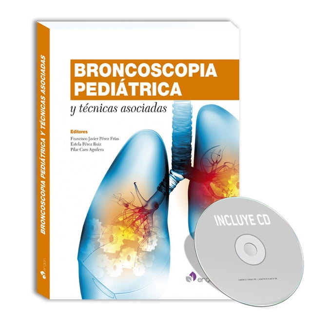 Broncoscopia pediátrica y técnicas asociadas + DVD Blanco