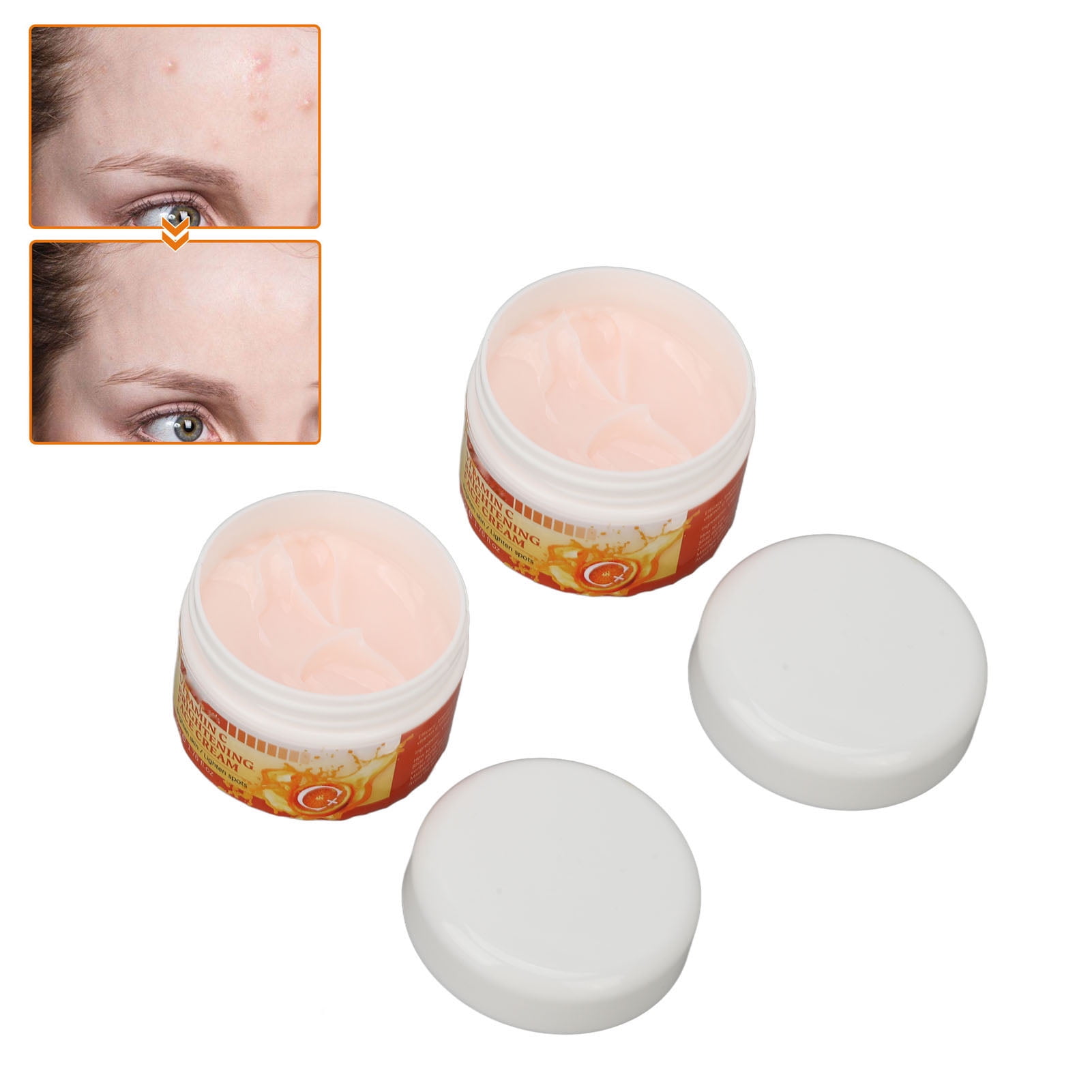 Buy Cream, Pimple Marks Removal Repair Vitamin C Face Cream