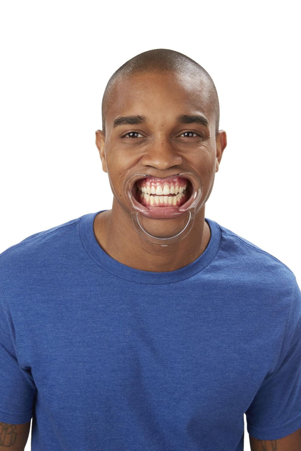 Jeu Mâche mots (Francais)- Inclut 10 mâche-mots (écarteurs buccaux)