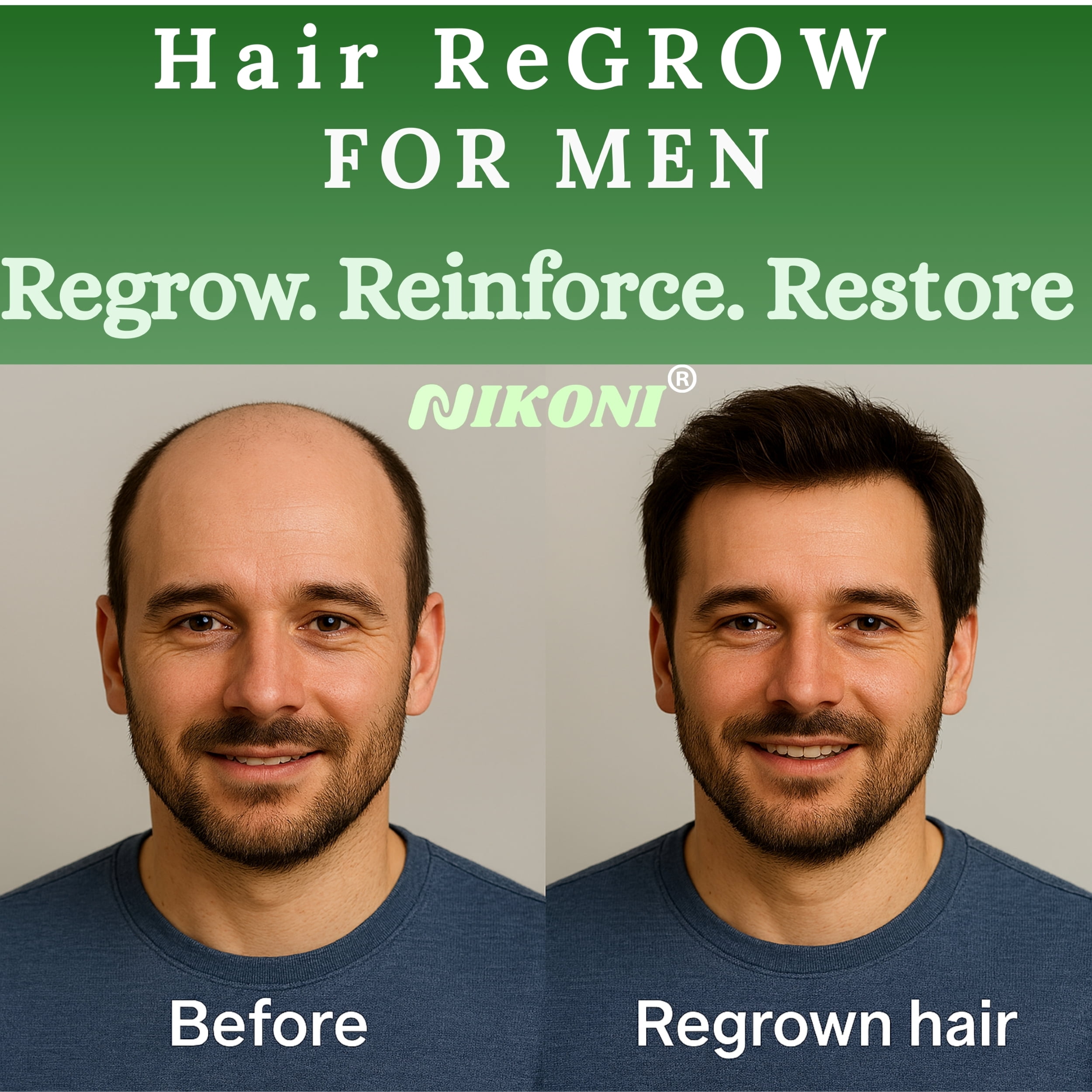 Nikoni Men's Hair ReGROW Liposomal Vegan Softgels with Biotin, Keratin, Saw Palmetto & Essential Nutrients-60 Vegan Softgels
