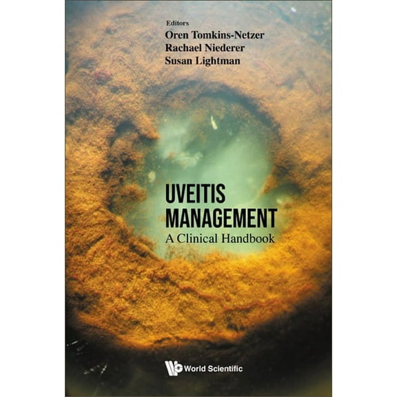 Uveitis Management: A Clinical Handbook, (Hardcover)