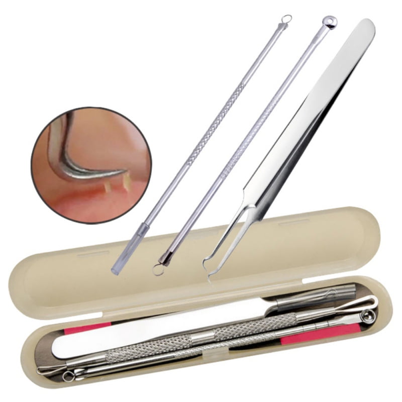 Blackhead Remover Extractor Tool Pimple Popper Acne Comedone Extraction Kit for Nose Facial Pore,Blemish Whitehead Popping -Stainless Steel