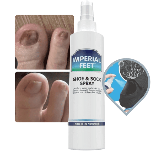 Athletes Foot Shoe Spray for Fungal Nail Treatment | Athletes Foot & Anti Toe Nail Fungus Treatment and Foot Fungus | Ringworm Foot Care Shoe Freshener | 150 ML