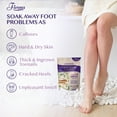 thumbnail image 2 of Fivona Foot Soak Blend Epsom Salt with Lavender 14.1 oz - Calming Foot Bath Salt, Relax & Renew Tired Feet, Soothe Soreness, Soften Calluses, 2 of 8
