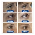 thumbnail image 3 of Fiudx Ofertas Del Día Crema Para Ojos Con Proteína Y Aloe, Crema Para Ojos Con Ojeras, Pomada De Jazmín, Ojeras Negras, 3 of 6