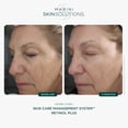 thumbnail image 3 of Loción Facial Marini SkinSolutions Retinol Plus Anti-Edad 30 ml, 3 of 7