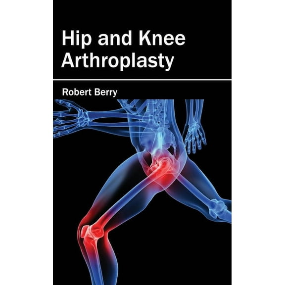 Hip and Knee Arthroplasty, (Hardcover)