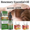 thumbnail image 2 of Eelhoe Rosemary Hair Growth Oil Fast Growing Anti Hair Loss Essential Oil Repair Damage Baldness Scalp, 2 of 5