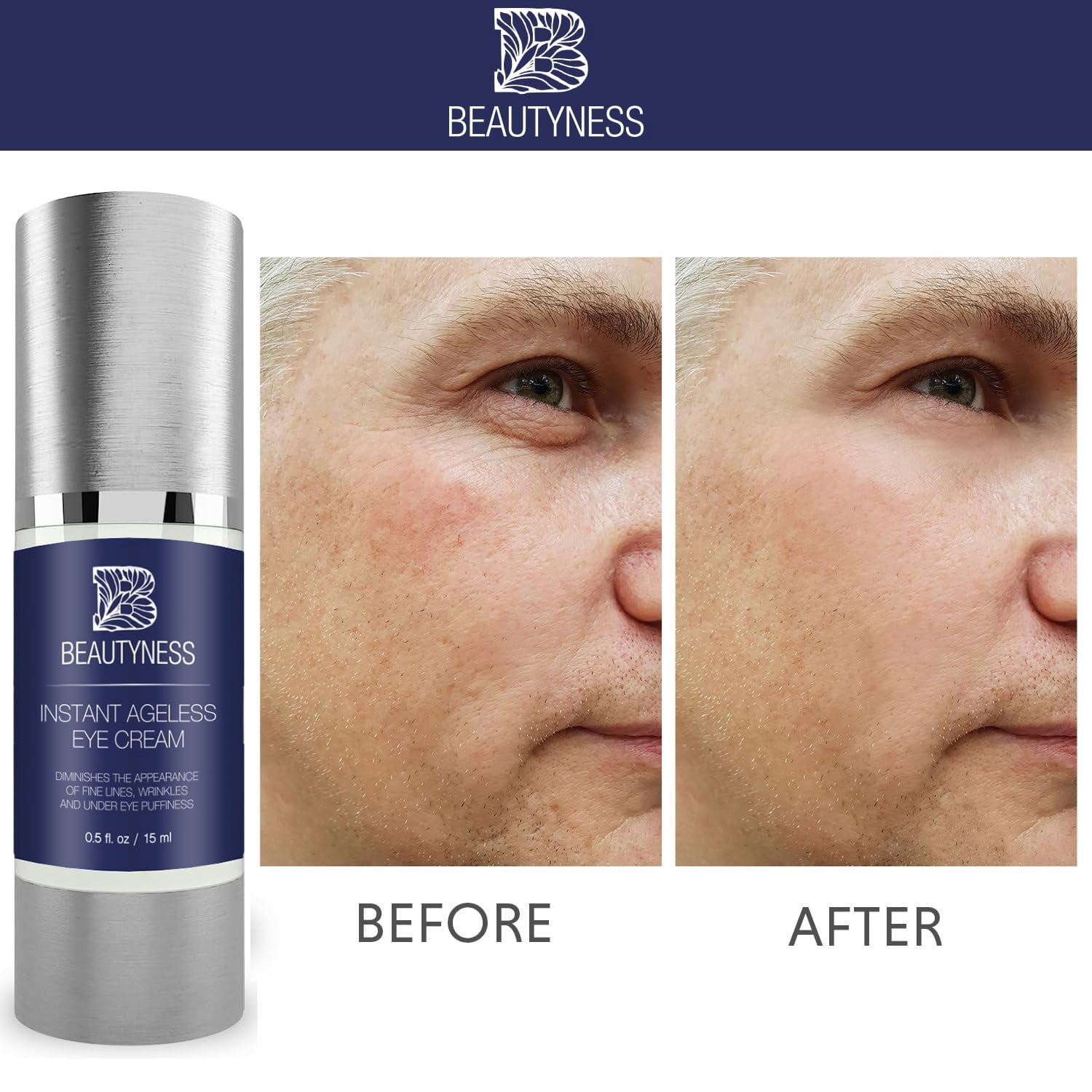 Instant Ageless Eye Cream Anti Wrinkle Cream, Removes Under Eye Puffiness, Bags, Expression Lines, & Dark Circles. Powerfully Tighen & Lifts Sagging Skin. Disappears Before Your Eyes In Minutes.