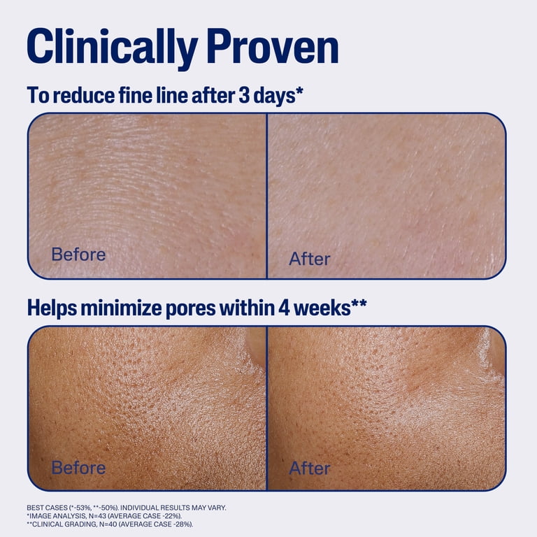 Cetaphil Advanced Defense AM Face Serum For Sensitive Skin photo 4