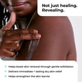 thumbnail image 4 of Amlactin Intensive Healing Body Lotion For Dry Skin, 14.1 Oz, 4 of 11