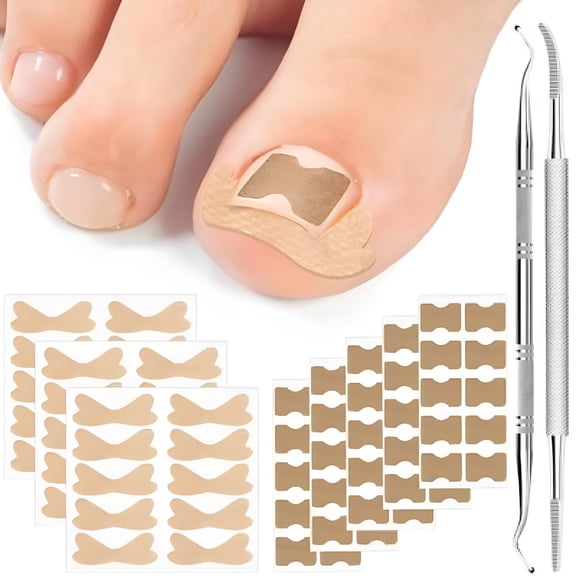 QARUN Ingrown Toenail Treatment,Breathable Corrector Patch,Ingrown Toenail Strips,Ingrown Toenail Treatment