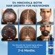 thumbnail image 3 of Minoxidil Spray Felicemy 5% para el crecimiento del cabello en hombres y mujeres, 3 of 7
