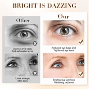 HYLLai Vitamin C Eye Balm Stick – Brightening Under-Eye Treatment for Dark Circles & Puffiness, Portable Twist-Up Stick for On-the-Go Use,